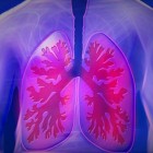 Longziektes en problemen met longen en luchtpijp